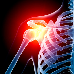 Reverse Shoulder Replacement in Reading PA