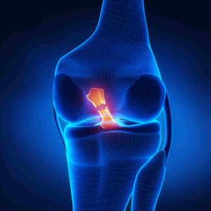 ACL Reconstruction in Berks County