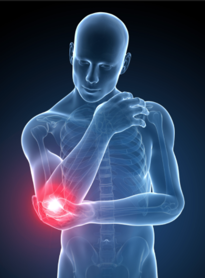 what to expect after tennis elbow surgery